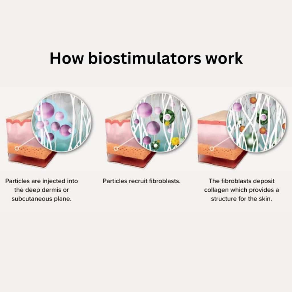 What Is a Biostimulator?